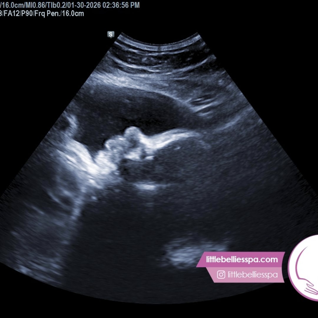 Photo shared by Cristin for their Babylist baby registry.