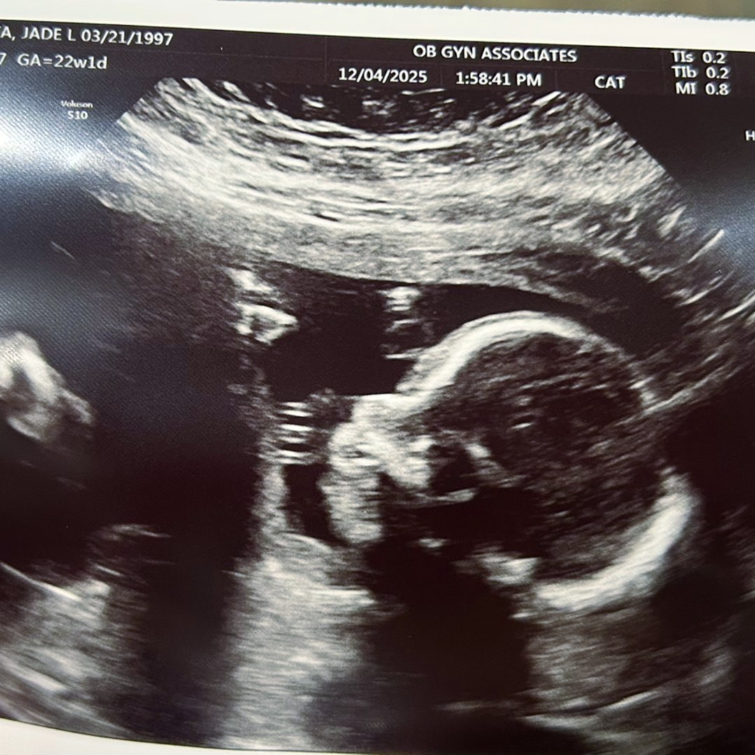 Photo shared by Jade Lynn for their Babylist baby registry.