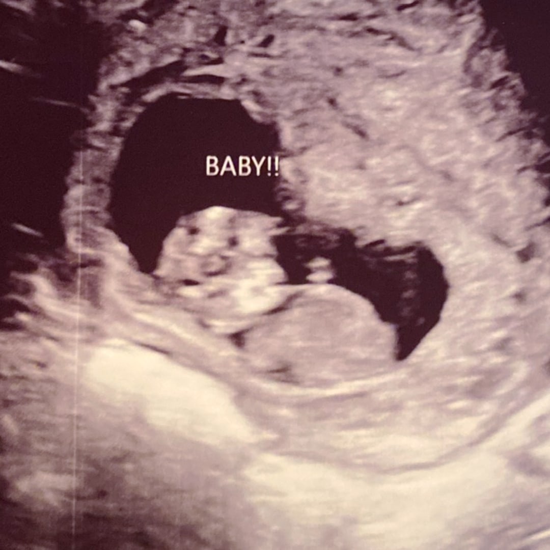 Photo shared by Nicole Regina for their Babylist baby registry.
