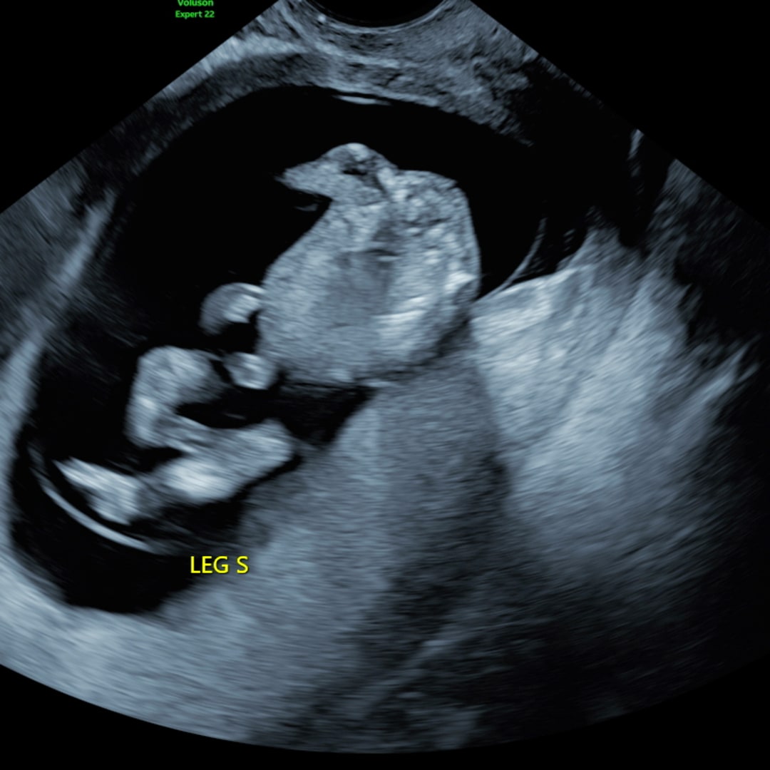 Photo shared by Sonia for their Babylist baby registry.