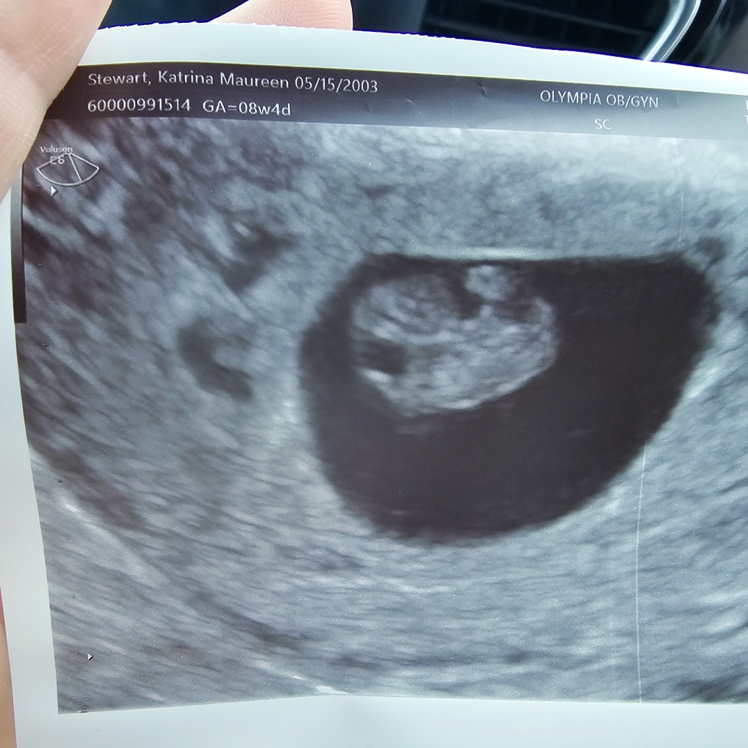 Photo shared by Katrina for their Babylist baby registry.