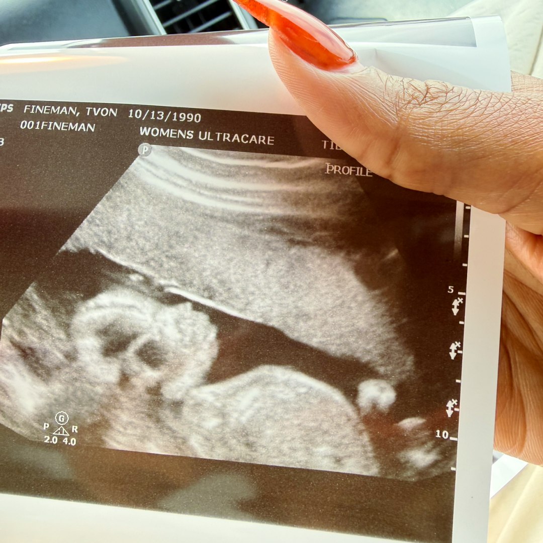 Photo shared by Tvon for their Babylist baby registry.