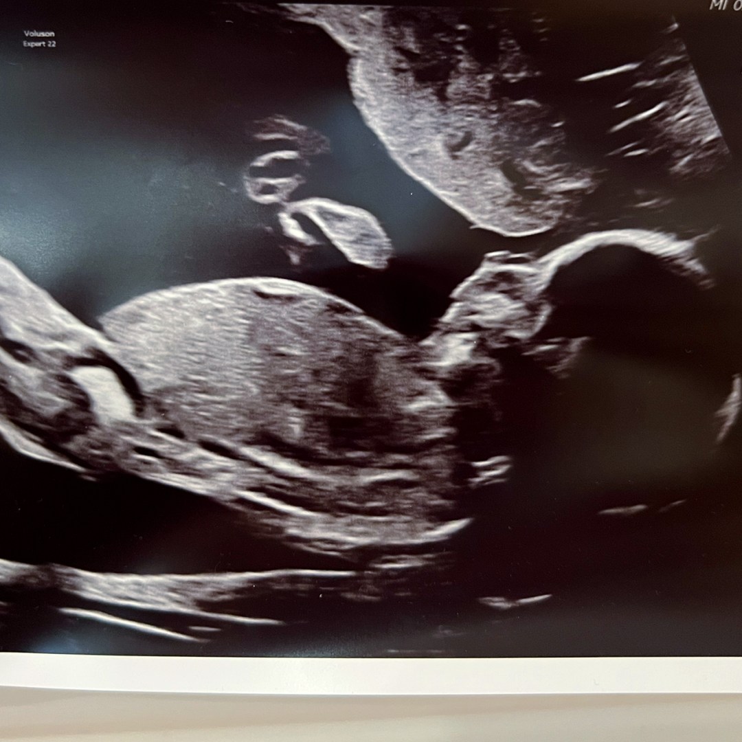 Photo shared by Ashley for their Babylist baby registry.