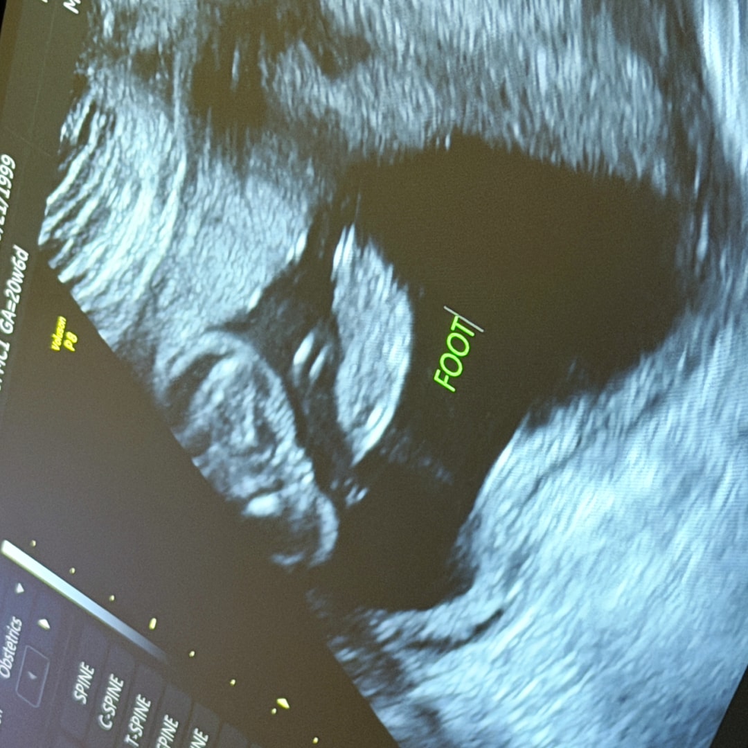 Photo shared by Abigail for their Babylist baby registry.