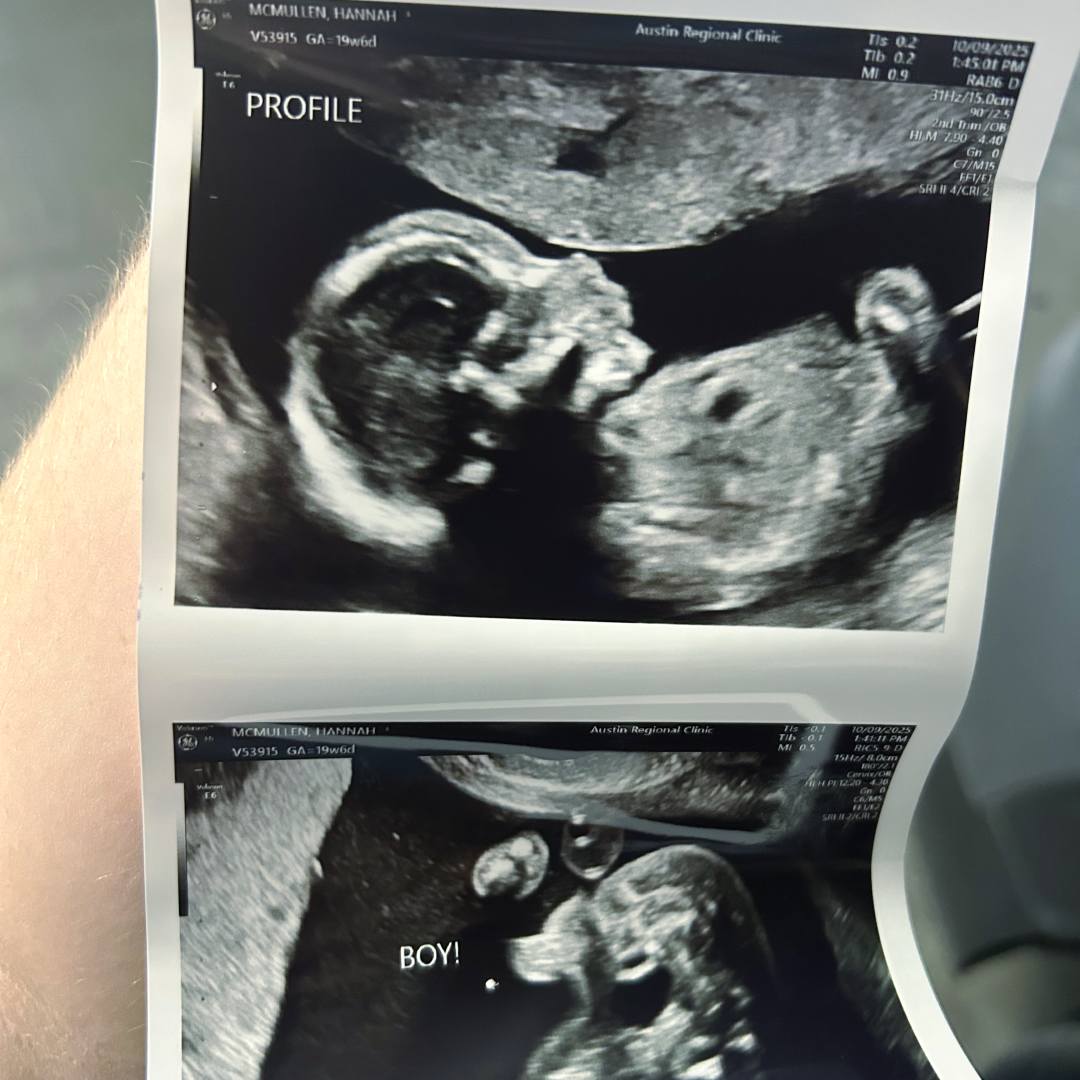 Photo shared by Hannah for their Babylist baby registry.