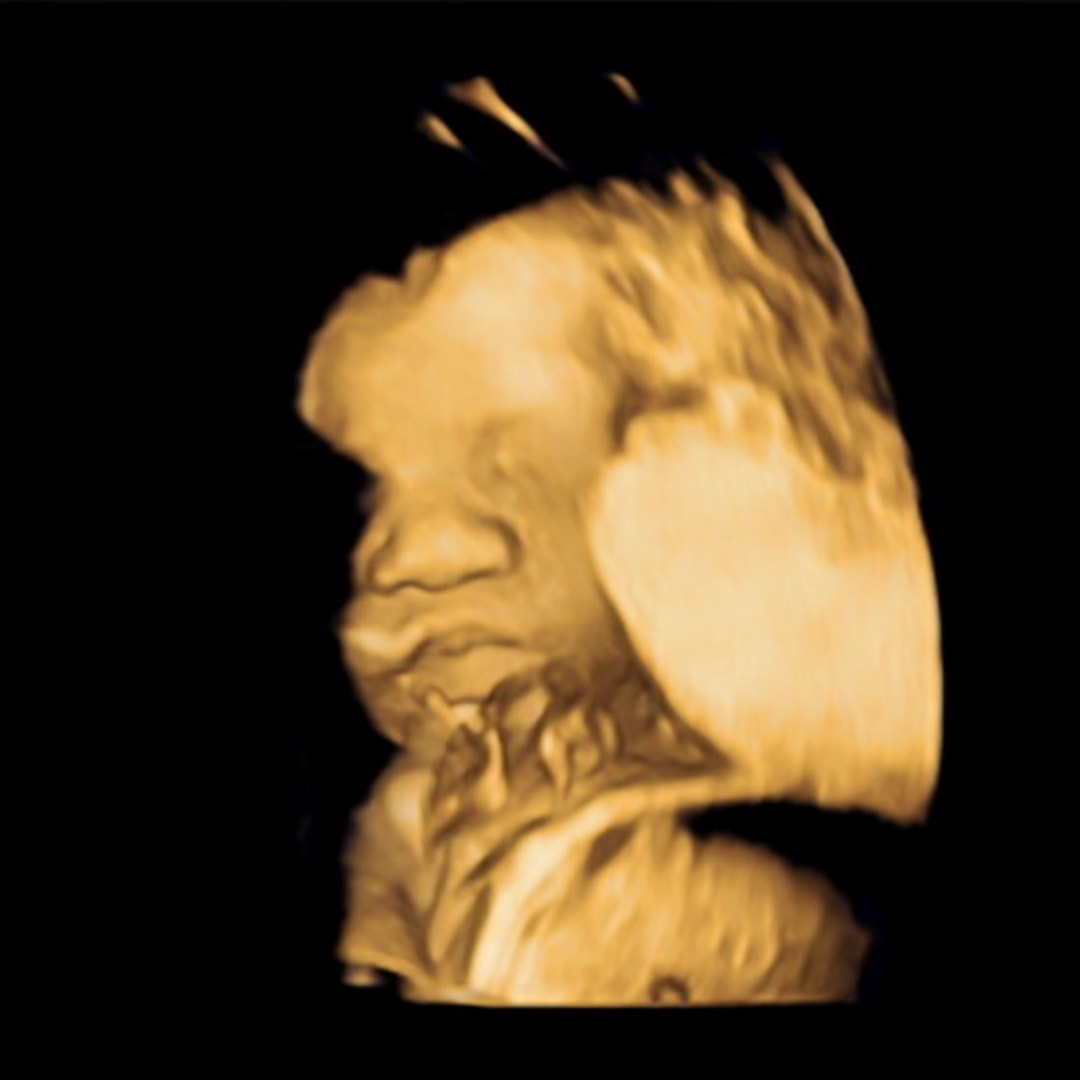 Photo shared by Makayla for their Babylist baby registry.