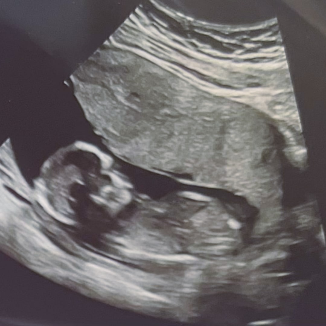 Photo shared by Allyson for their Babylist baby registry.