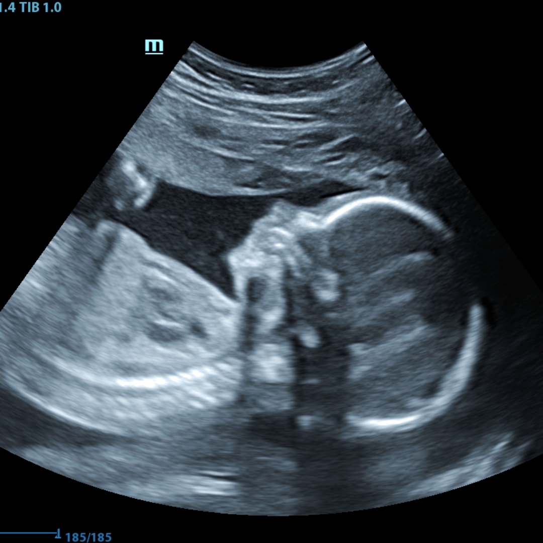 Photo shared by Jasmine for their Babylist baby registry.