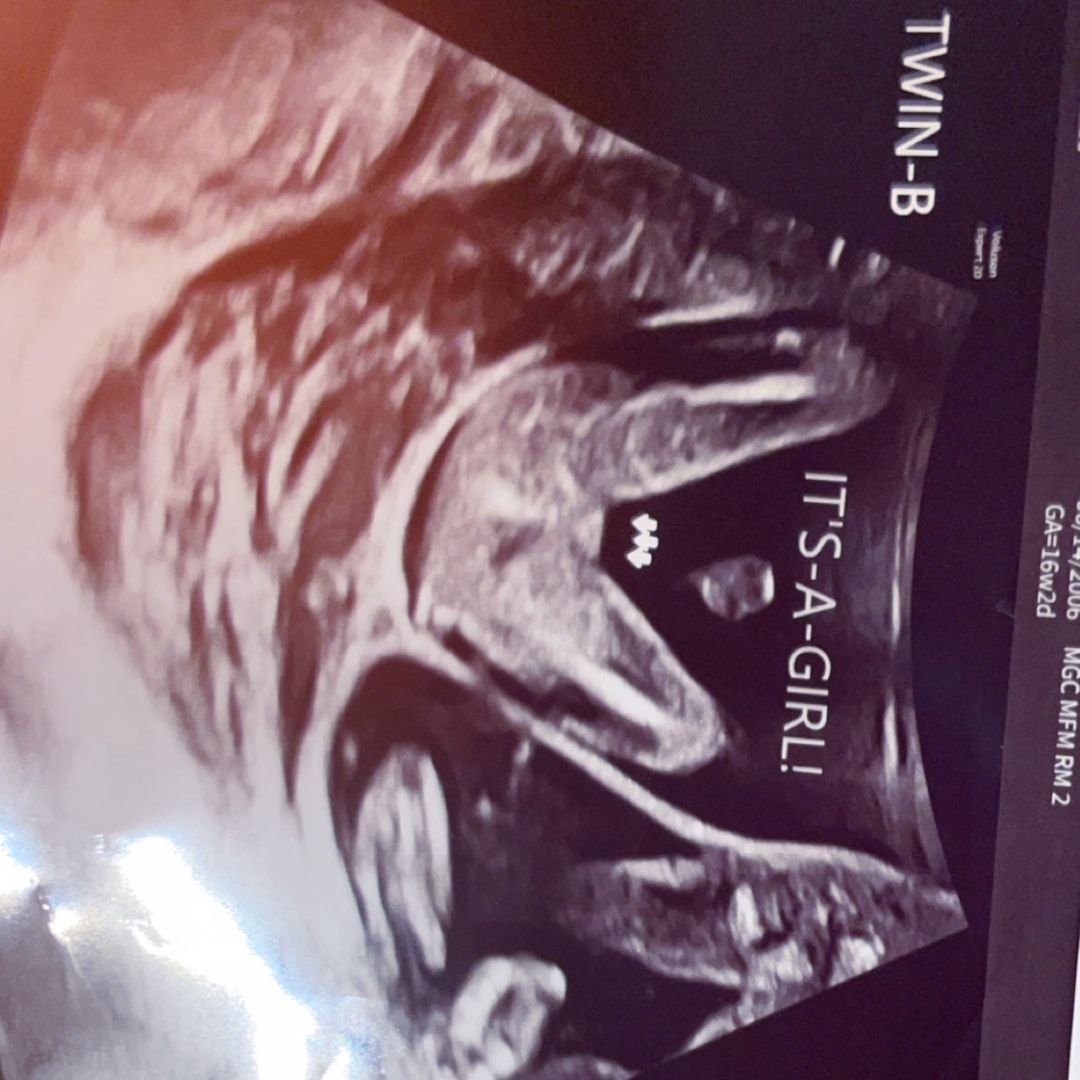 Photo shared by Ariyana for their Babylist baby registry.