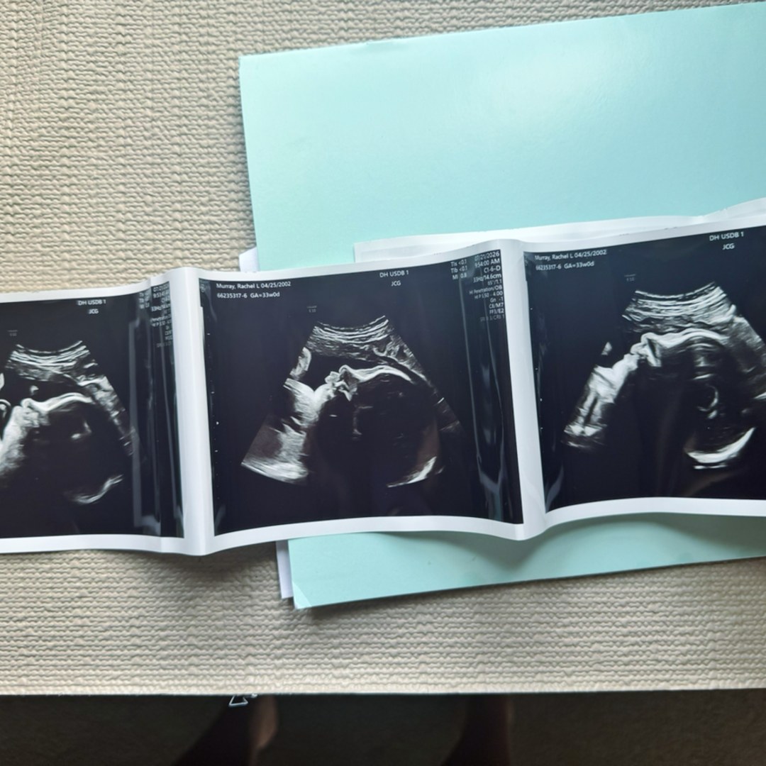 Photo shared by Rachel for their Babylist baby registry.