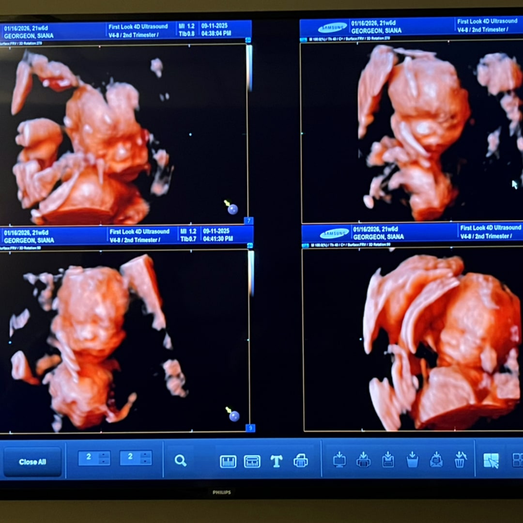 Photo shared by Siana for their Babylist baby registry.