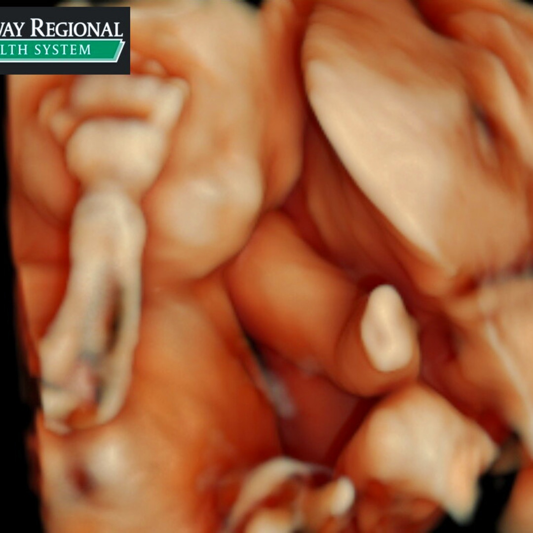 Photo shared by Janay for their Babylist baby registry.