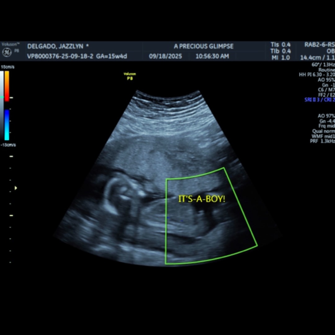 Photo shared by Jazzlynn for their Babylist baby registry.