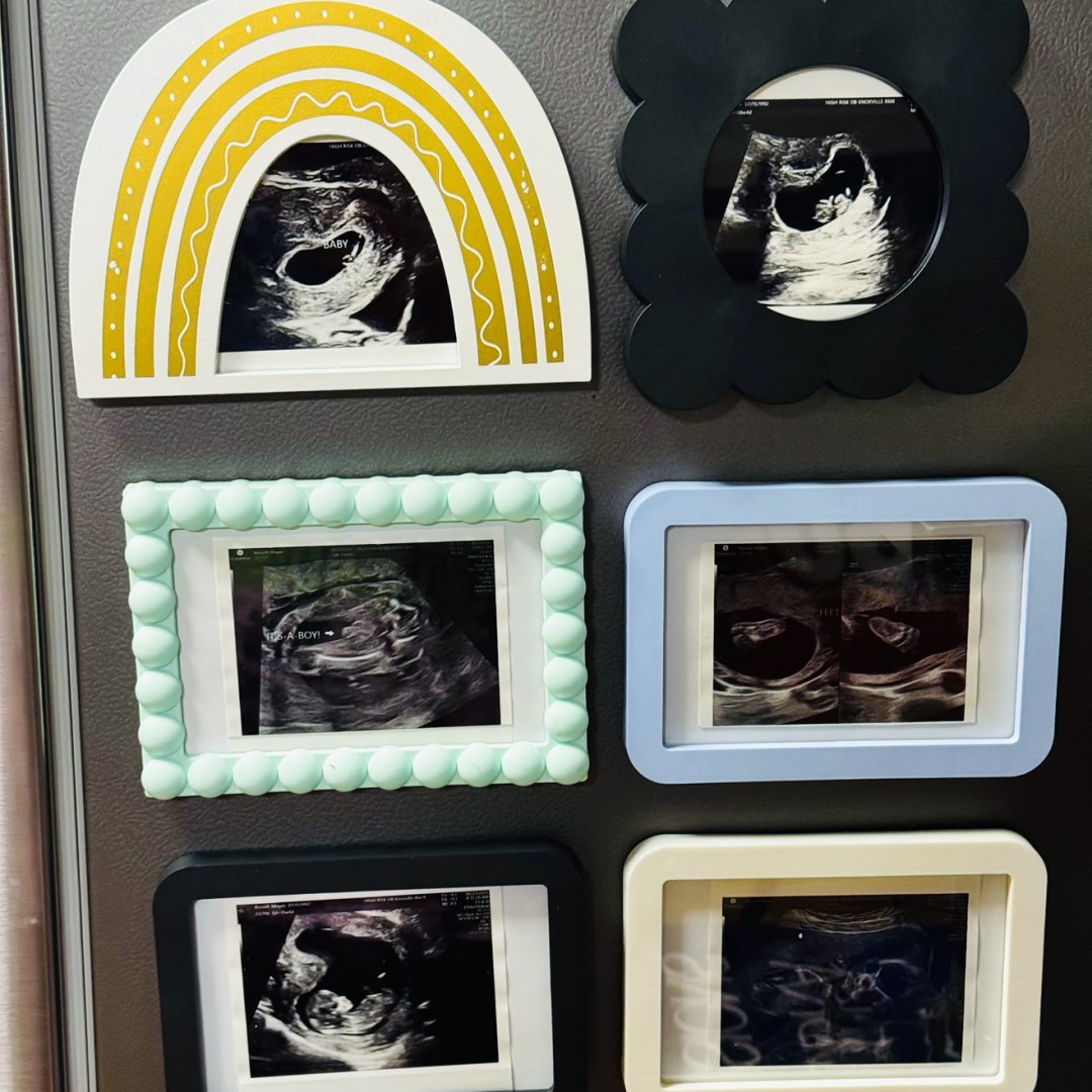 Photo shared by Megan for their Babylist baby registry.