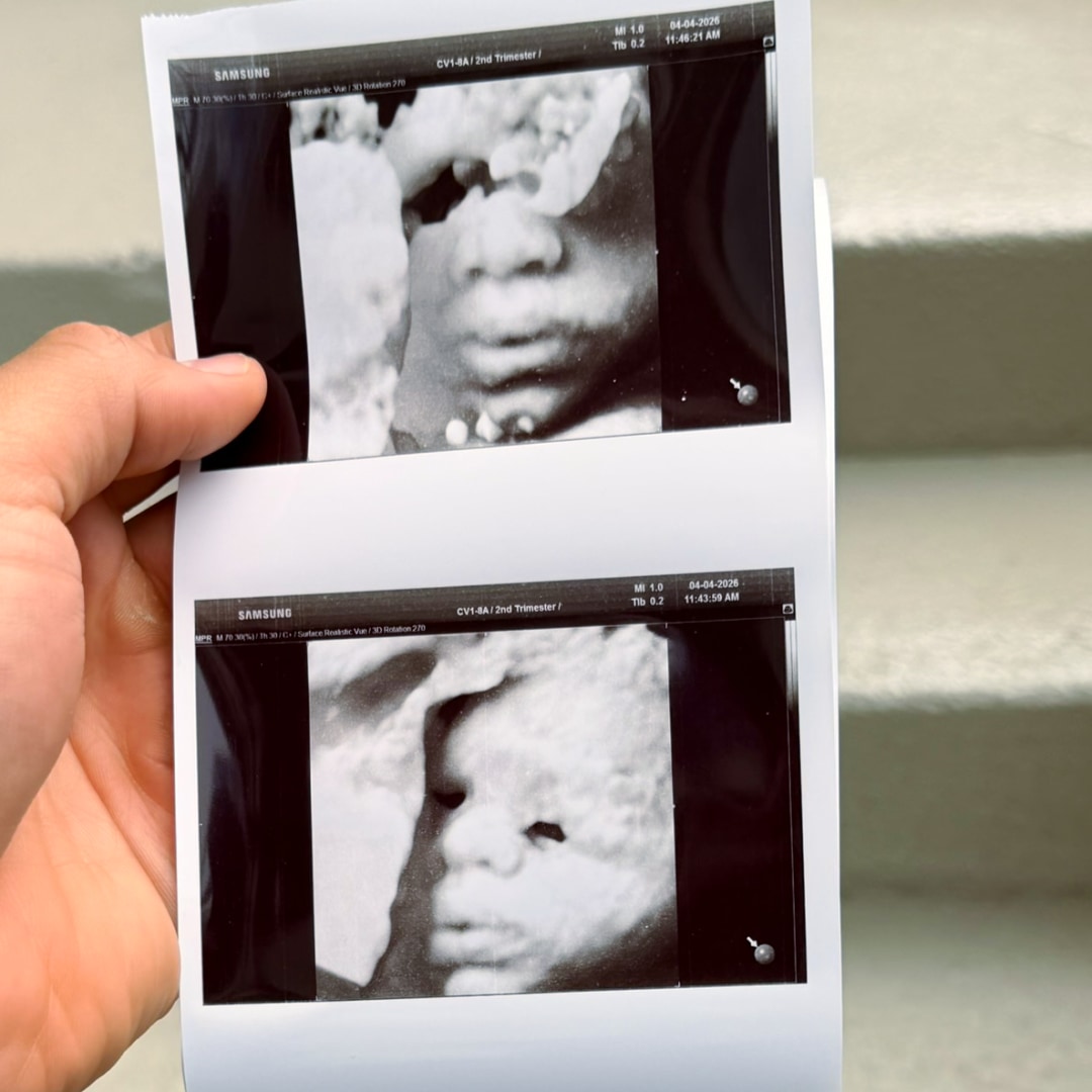 Photo shared by Alison for their Babylist baby registry.