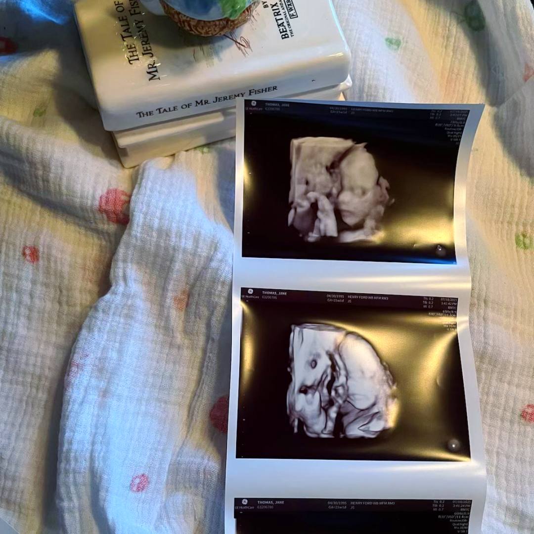 Photo shared by Jane for their Babylist baby registry.