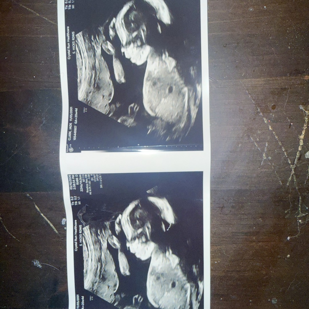 Photo shared by Jade for their Babylist baby registry.