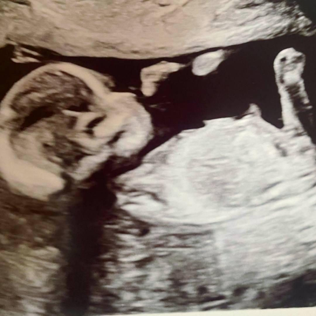 Photo shared by Aisha for their Babylist baby registry.