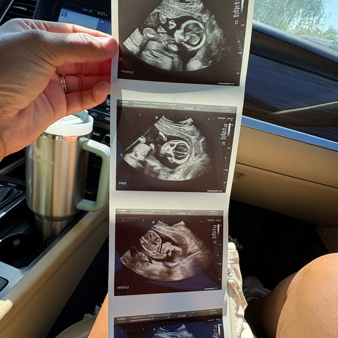 Photo shared by Jasmine for their Babylist baby registry.