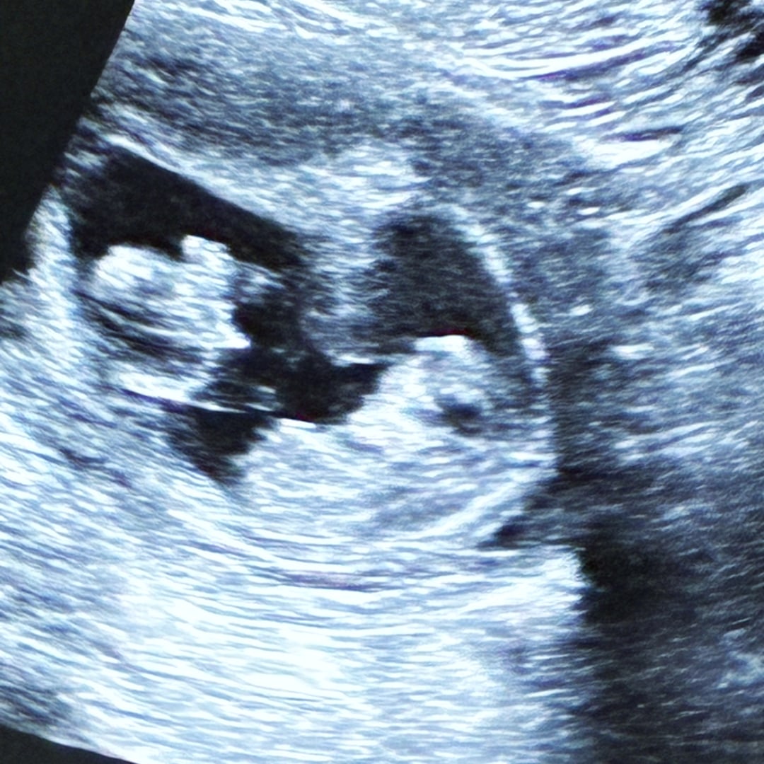 Photo shared by Amalia for their Babylist baby registry.