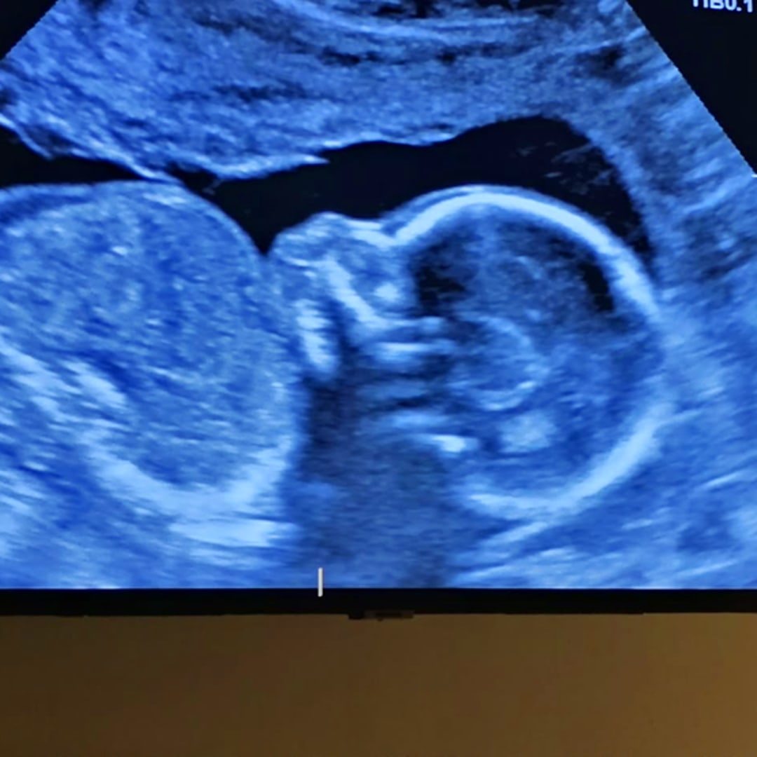 Photo shared by Caitlin for their Babylist baby registry.