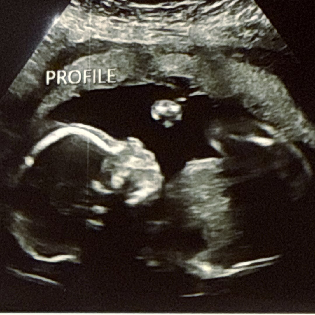 Photo shared by Briana for their Babylist baby registry.