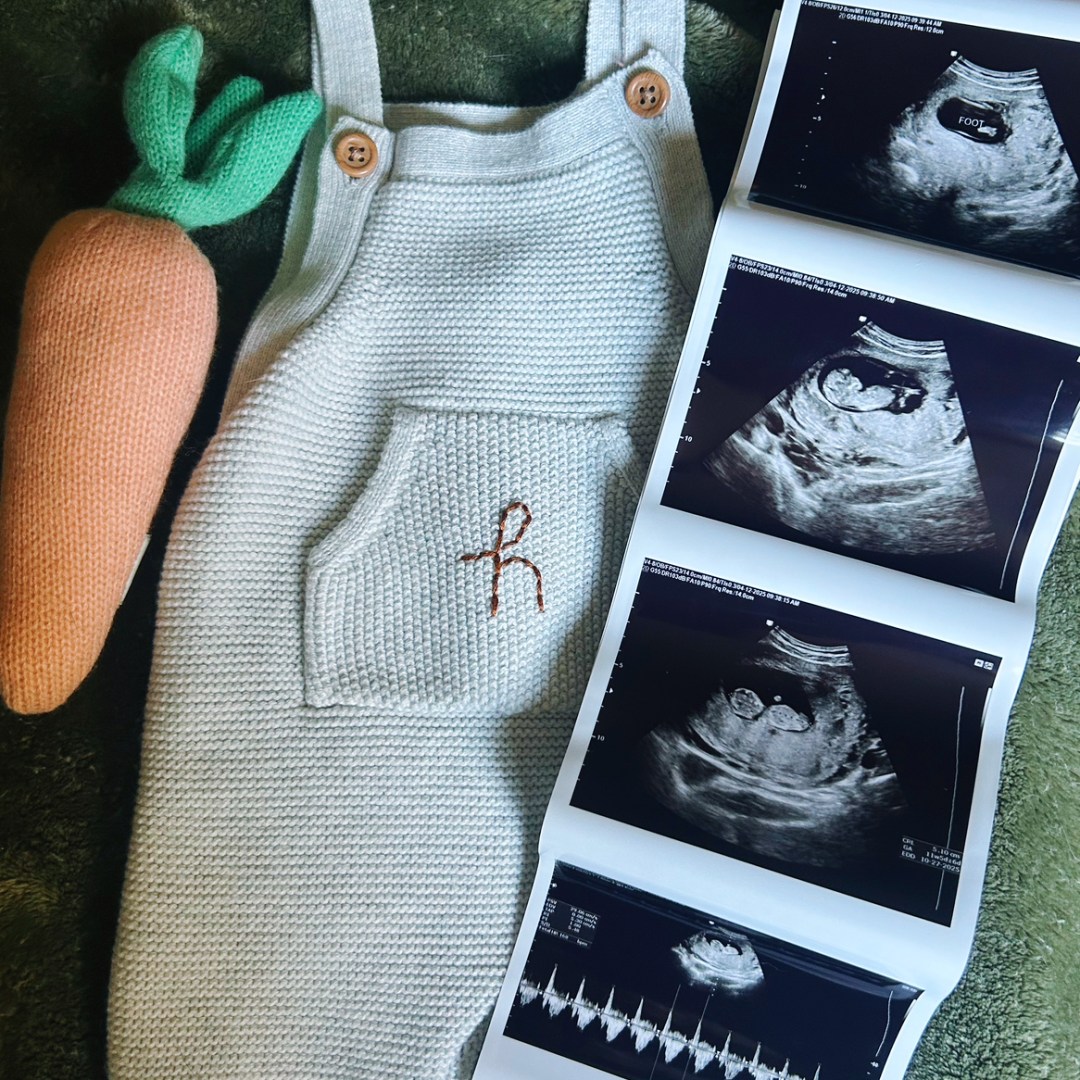 Photo shared by Abigail for their Babylist baby registry.