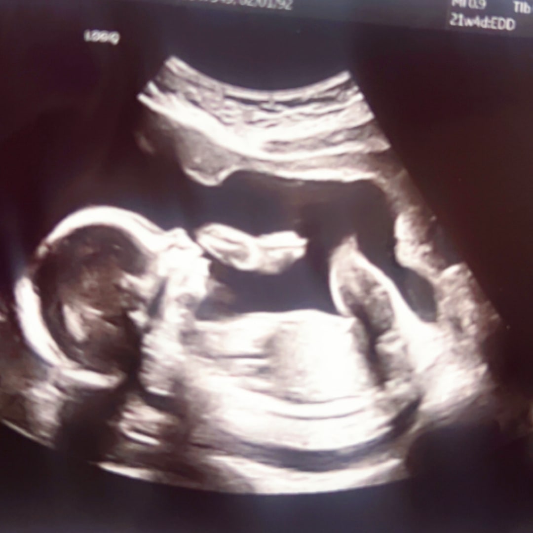 Photo shared by Angela for their Babylist baby registry.