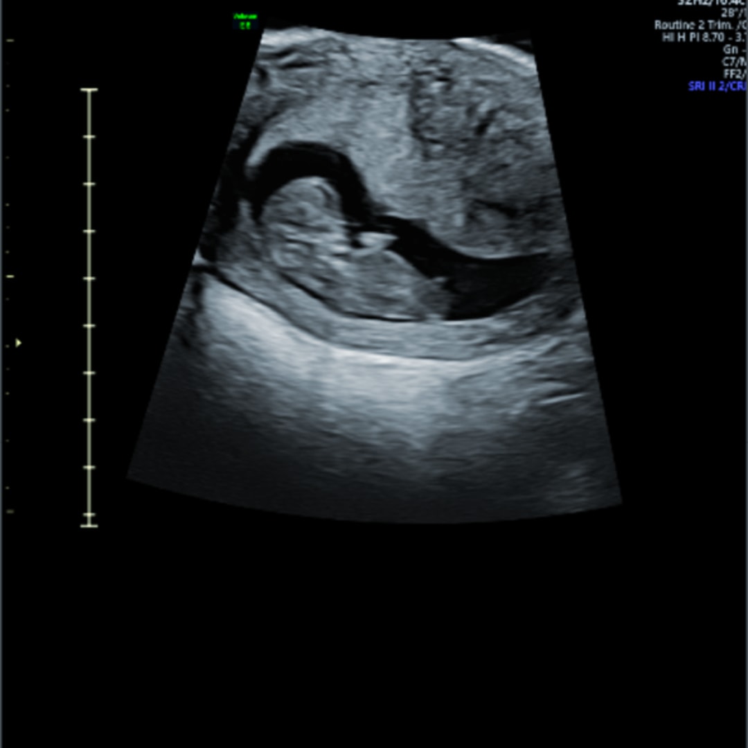 Photo shared by Lacey for their Babylist baby registry.