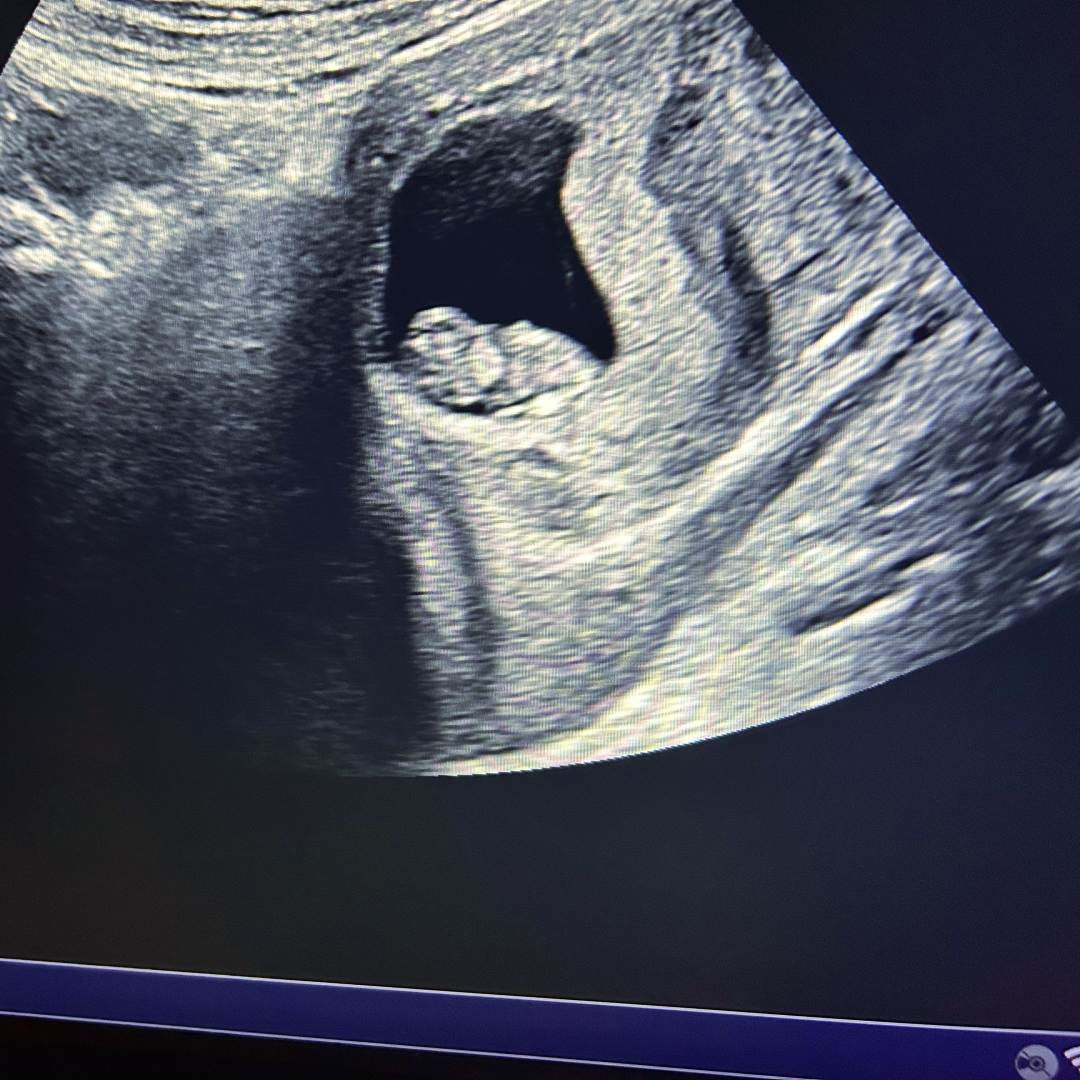 Photo shared by Yetzabelle S for their Babylist baby registry.