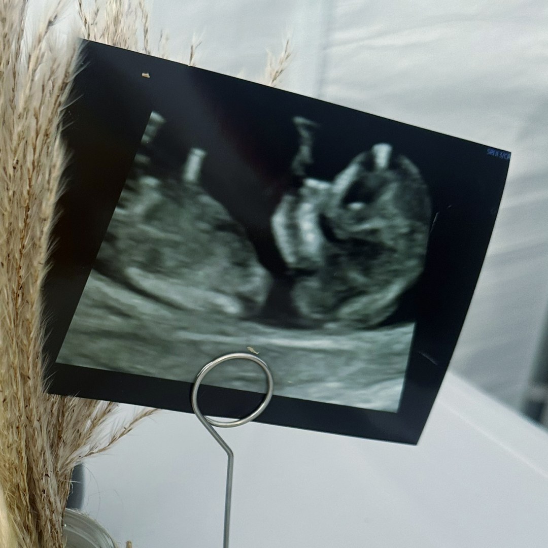 Photo shared by Estefani for their Babylist baby registry.