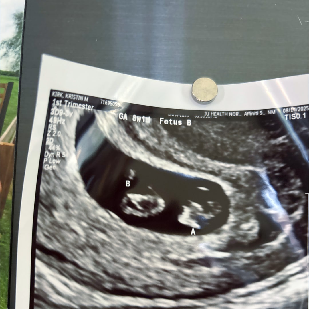 Photo shared by Kristin for their Babylist baby registry.