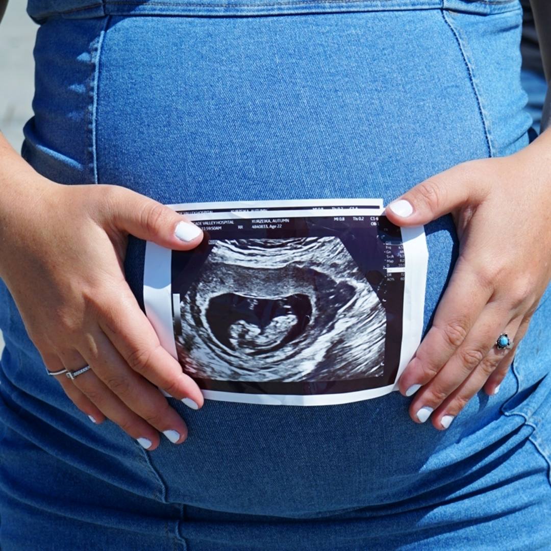 Photo shared by Autumn for their Babylist baby registry.