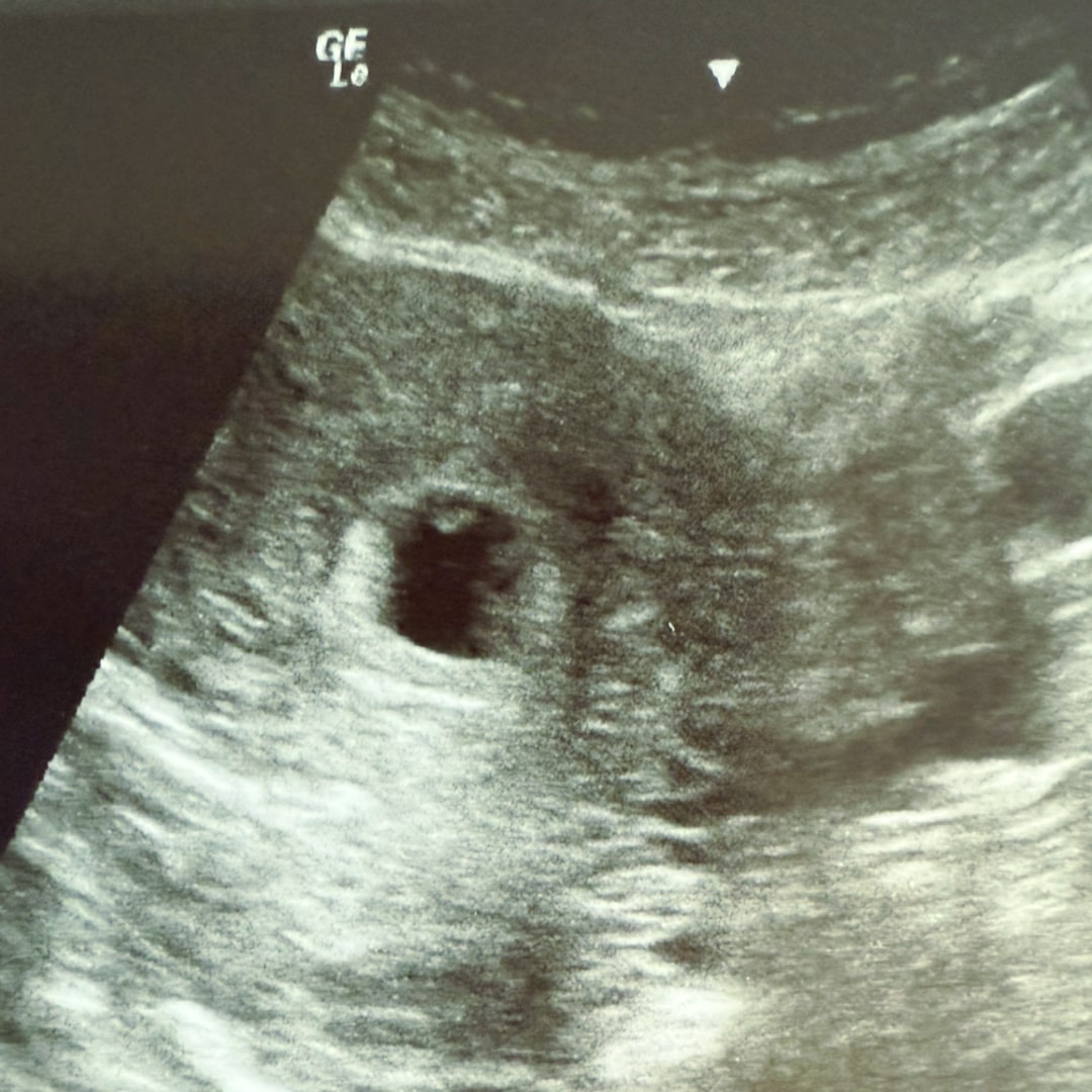 Photo shared by Claudia for their Babylist baby registry.