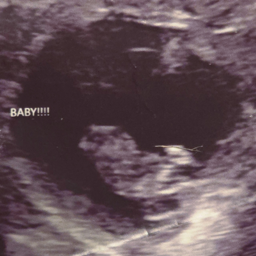 Photo shared by Marisol for their Babylist baby registry.