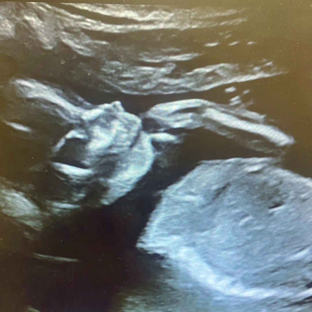 Photo shared by Brianna for their Babylist baby registry.