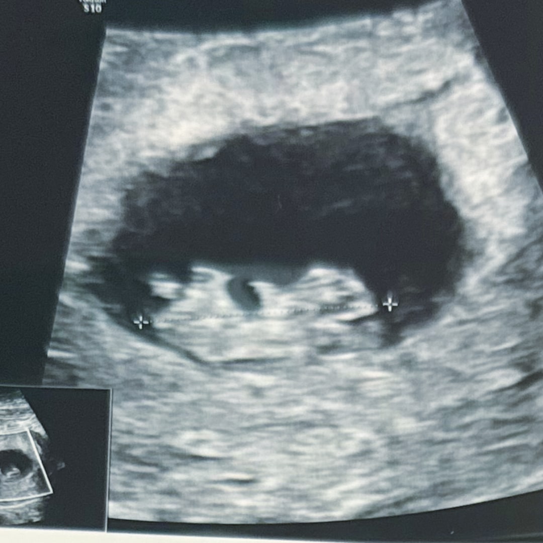 Photo shared by Trinity for their Babylist baby registry.
