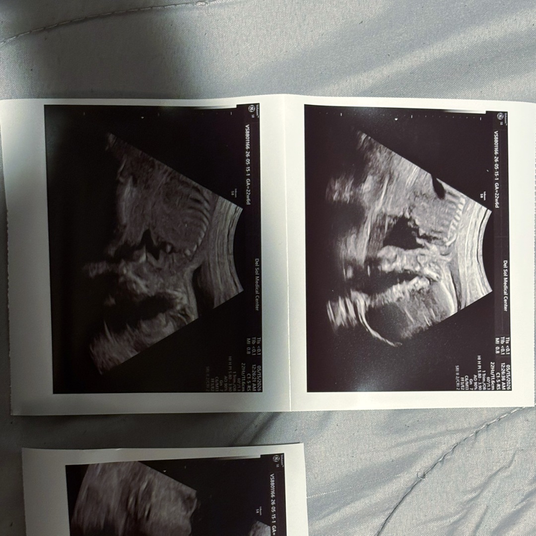 Photo shared by Samantha for their Babylist baby registry.