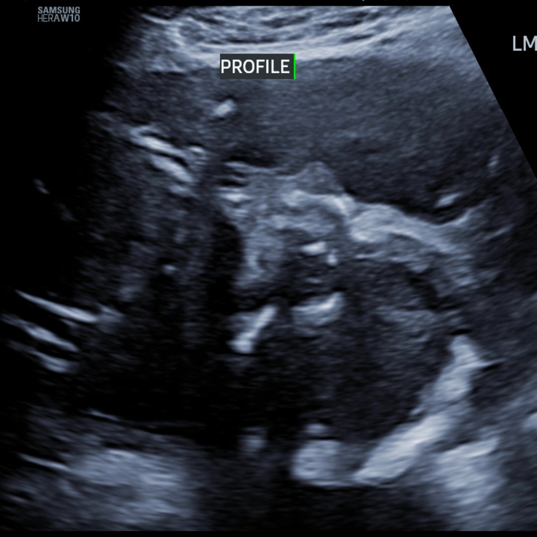 Photo shared by Morgan for their Babylist baby registry.