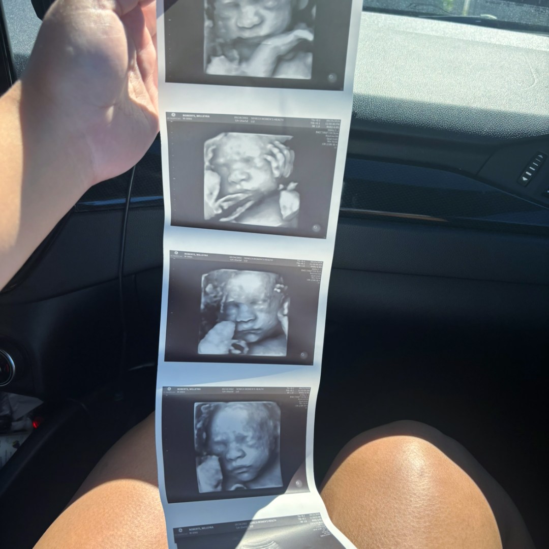 Photo shared by Willeyka for their Babylist baby registry.