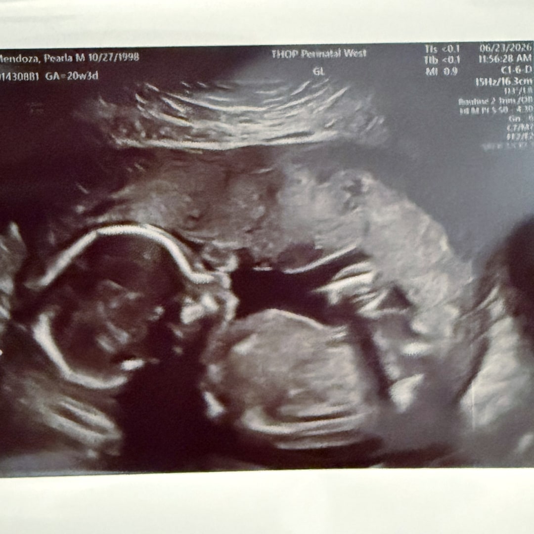 Photo shared by Pearla for their Babylist baby registry.