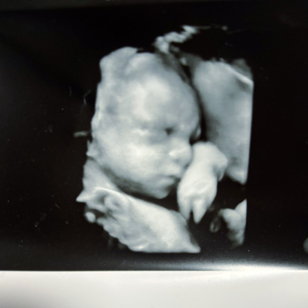 Photo shared by Chelsea for their Babylist baby registry.