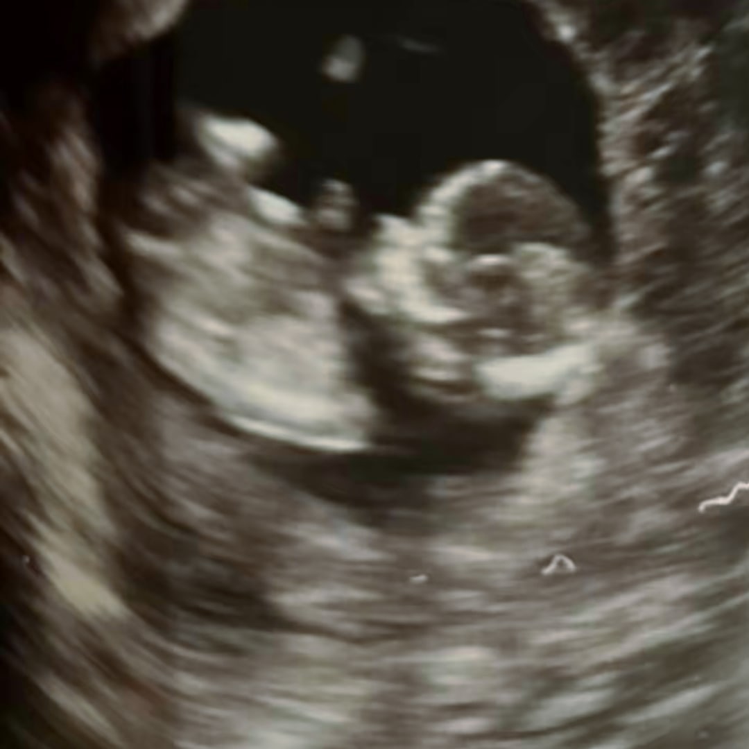 Photo shared by Katrina for their Babylist baby registry.