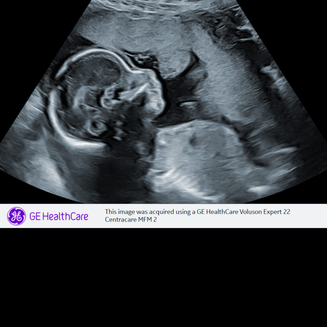 Photo shared by Brianna for their Babylist baby registry.