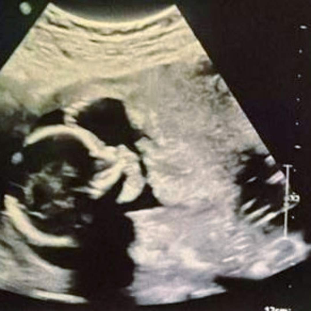 Photo shared by Kell for their Babylist baby registry.