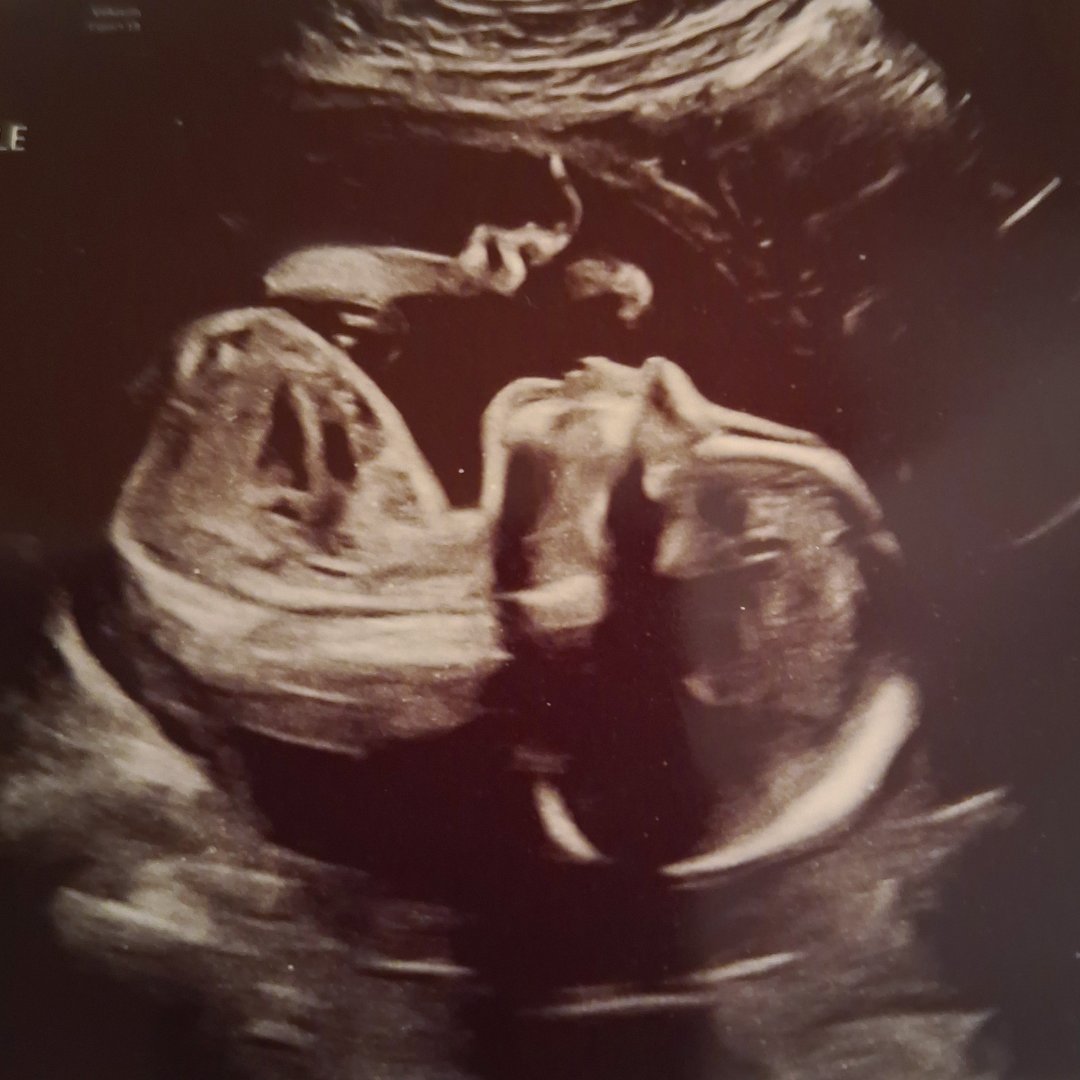Photo shared by Whitney for their Babylist baby registry.