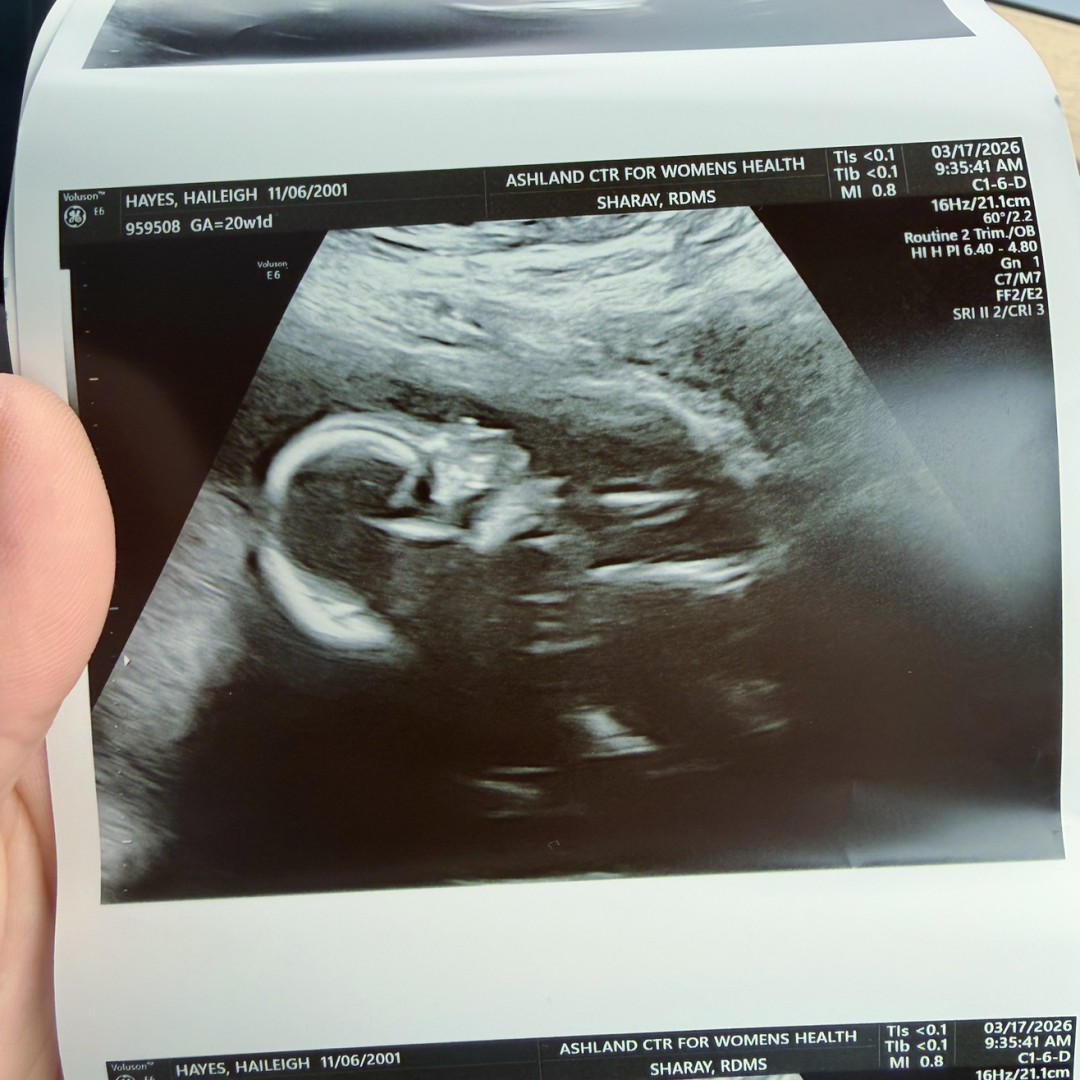 Photo shared by Haileigh for their Babylist baby registry.