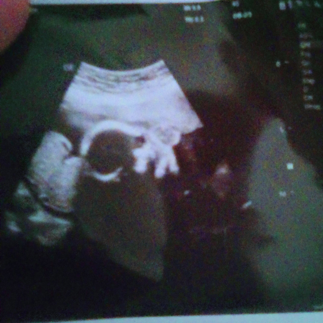 Photo shared by Marilyn for their Babylist baby registry.