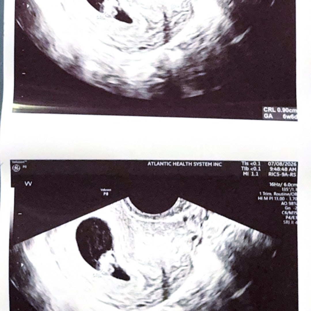 Photo shared by Jade for their Babylist baby registry.