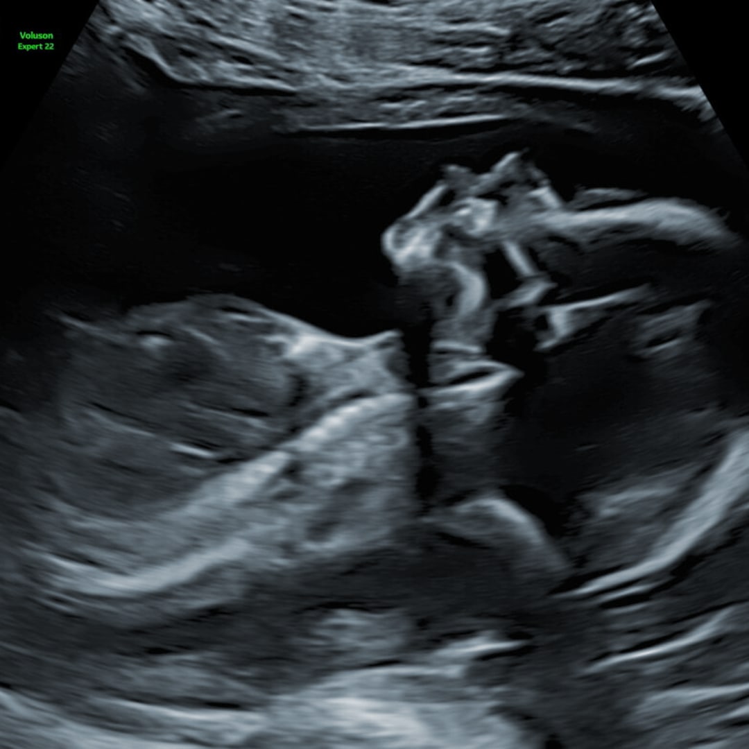 Photo shared by Yesenia for their Babylist baby registry.